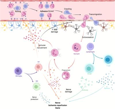 Systemic immune responses after ischemic stroke: From the center to the periphery